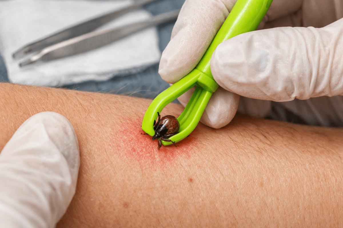 5x Producten tegen teken